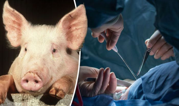  Hukum Transplantasi Katup Jantung Babi Pada Manusia