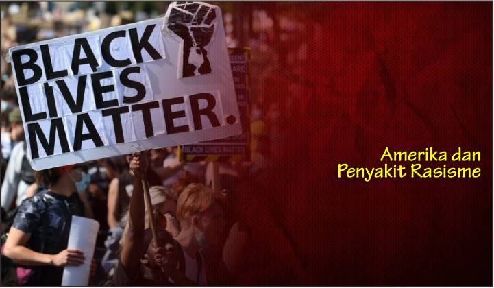  Amerika dan Penyakit Rasisme